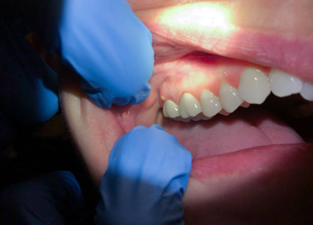 Best Mobile Emergency Dentist in Palos Park, IL