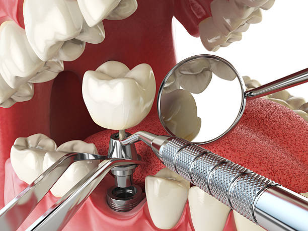 Best Weekend Emergency Dentist in Palos Park, IL